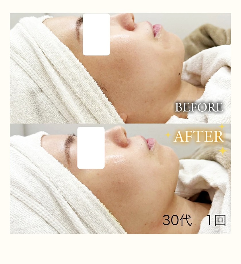 �ץ饺�ޥ����Ƥη����ǡ�PLAVITA�ʥץ����������